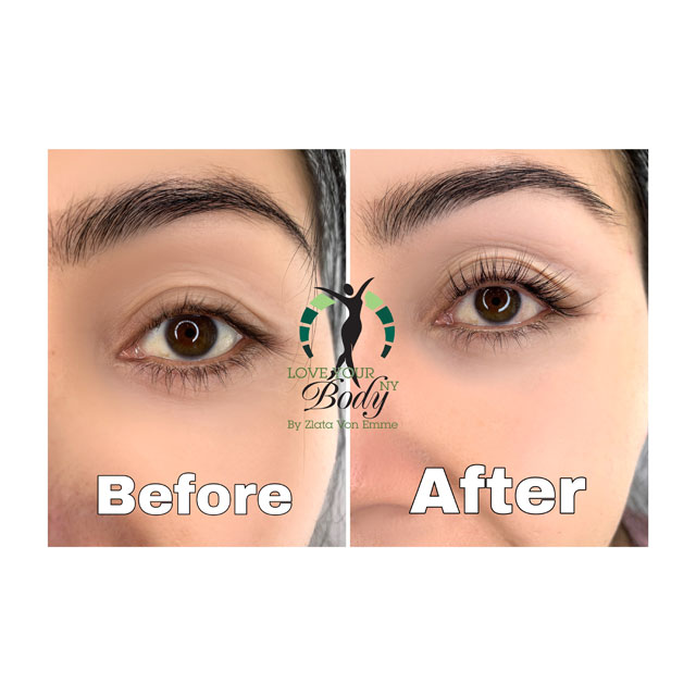 Lash Lifting Before and After